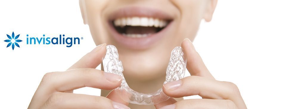 ortodoncia invisible invisalign 2