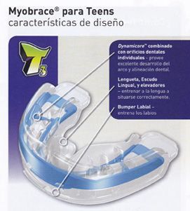 ortodoncia sin brackets teens 2 ortodoncia sin brackets teens 2