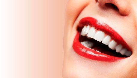 estetica dental La Sagrera Barcelona.