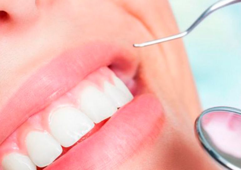 profilaxis dental blaudent profilaxis dental blaudent