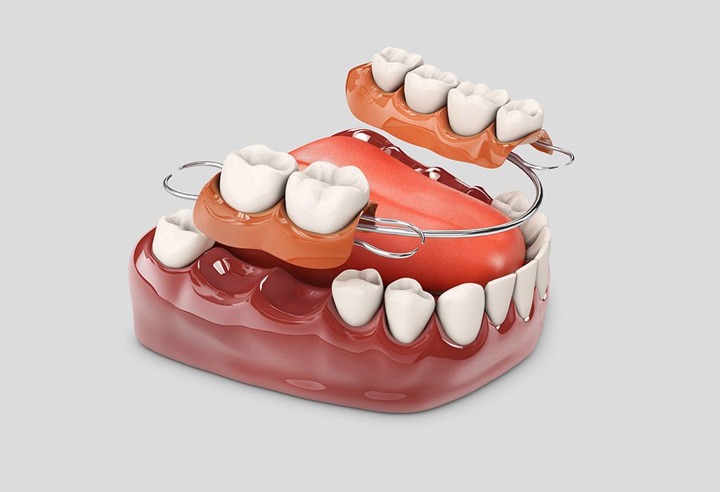 protesis dental mixta en La Sagrera protesis dental mixta en La Sagrera
